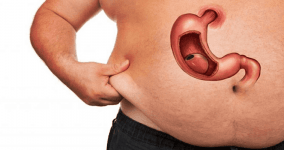 Tüp Mide Ameliyatı Fiyatları, Ameliyat Sonrası ve Tüm Detaylar