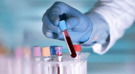 Demir Yüksekliği Belirtileri Nelerdir? Neden Olur? Nasıl Geçer?