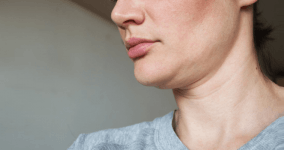 Gıdık Nedir? Gıdı Sarkması Neden Olur?