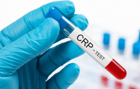 CRP Nedir? CRP Yüksekliği Ne Anlama Gelir? Nasıl Düşürülür?