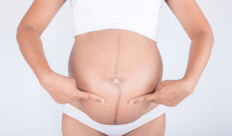 Hamilelikte Göbek Çizgisi (Linea Nigra) Nedir? Neden Olur? Nasıl Geçer?