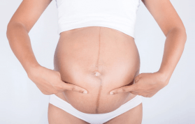 Hamilelikte Göbek Çizgisi (Linea Nigra) Nedir? Neden Olur? Nasıl Geçer?
