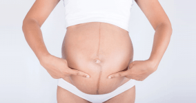 Hamilelikte Göbek Çizgisi (Linea Nigra) Nedir? Neden Olur? Nasıl Geçer?