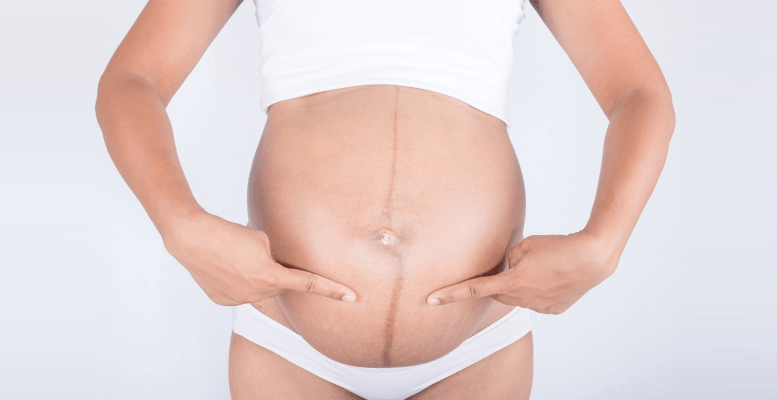 Hamilelikte Göbek Çizgisi (Linea Nigra) Nedir? Neden Olur? | Obezite Haber