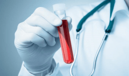 MPV (Mean platelet volume) Nedir? MPV Yüksekliği ve Düşüklüğü