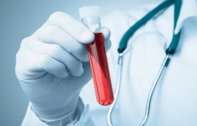 MPV (Mean platelet volume) Nedir? MPV Yüksekliği ve Düşüklüğü