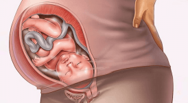 Gebelikte Plasenta Previa Nedir? Durumu Nasıl Olmalıdır?