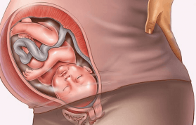 Gebelikte Plasenta Previa Nedir? Durumu Nasıl Olmalıdır?