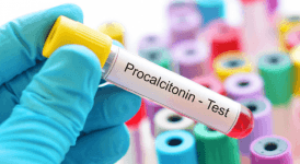 Prokalsitonin (PCT) Nedir? PCT Kaç Olmalıdır? PCT Yüksekliğinin Nedenleri