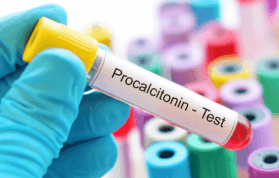 Prokalsitonin (PCT) Nedir? PCT Kaç Olmalıdır? PCT Yüksekliğinin Nedenleri
