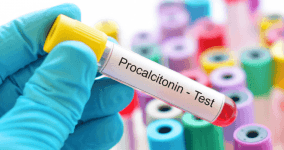 Prokalsitonin (PCT) Nedir? PCT Kaç Olmalıdır? PCT Yüksekliğinin Nedenleri