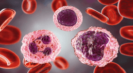 Monosit Yüksekliği Nedir? Monosit Yüksekliği Tedavisi