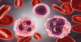 Monosit Yüksekliği Nedir? Monosit Yüksekliği Tedavisi