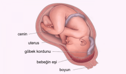 Bebeğin Eşinin Aşağıda Olması Ne Demektir? Plasenta Previa Ne Demektir?
