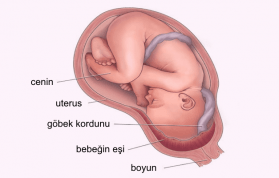 Bebeğin Eşinin Aşağıda Olması Ne Demektir? Plasenta Previa Ne Demektir?