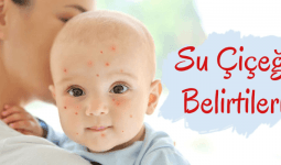 Bebekler Su Çiçeği Nasıl Geçer? Nedenleri ve Belirtileri Neler?