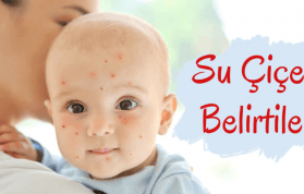 Bebekler Su Çiçeği Nasıl Geçer? Nedenleri ve Belirtileri Neler?
