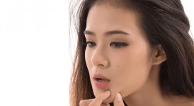 Yüzde Çıkan Beyaz Noktalar Neden Olur ve Nasıl Geçer?