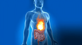 Reflü Olanlar Kahvaltıda Ne Yer? Reflü Diyeti Nasıl Yapılır?