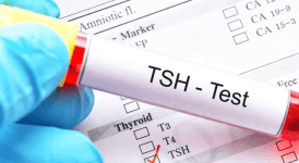 Serbest T4 Kaç Olmalıdır? Düşüklüğü, Yüksekliği Neden Olur?