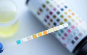 Ürobilinojen Testi Ne? Ürobilinojen Normal Değerleri Nedir?