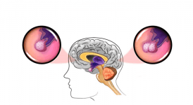 ACTH Nedir? ACTH Testi Nasıl Yapılır? Normal Değeri Nedir?
