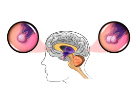 ACTH Nedir? ACTH Testi Nasıl Yapılır? Normal Değeri Nedir?