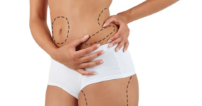 Yağ Aldırma Ameliyatı Nedir?